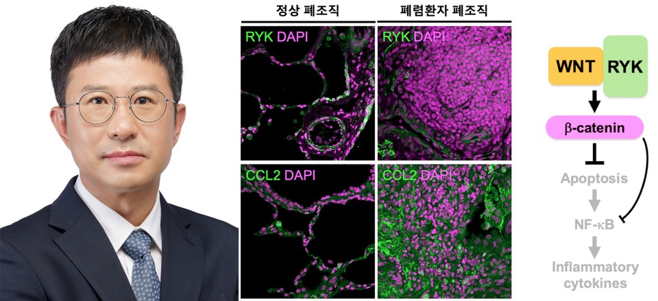 왼쪽부터 김현택 교수, 폐렴에서 RYK 및 사이토카인 발현변화와 발병 분자기전 모식도(사진=순천향대학교).