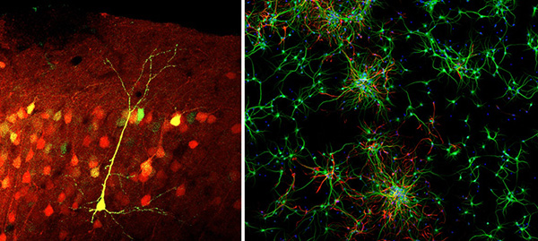 왼쪽 ST-Cal-Light를 이용해 표지된 운동학습시 활성화되는 신경세포들(노란색), 오른쪽은 ST-Cal-Light이 발현된 배양된 신경세포들.(사진=DGIST)